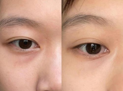 效果最好？抗皱效果测评五款出众眼霜J9数字平台眼霜哪个牌子抗皱去皱(图1)