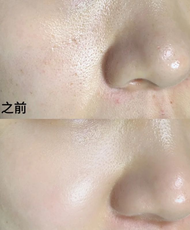 面膜十大平价好用补水面膜推荐！j9国际站国内公认最好用的十大(图4)